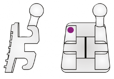 .018 Elite Opti-MIM Mini Twin 14/15 Qty. 10